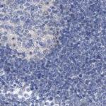 MPP10 Antibody in Immunohistochemistry (IHC)