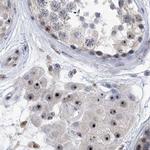 MPP10 Antibody in Immunohistochemistry (IHC)