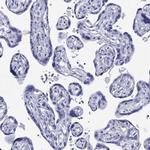 CRYGS Antibody in Immunohistochemistry (Paraffin) (IHC (P))