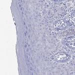 CRYGS Antibody in Immunohistochemistry (Paraffin) (IHC (P))