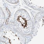 SMCP Antibody in Immunohistochemistry (Paraffin) (IHC (P))