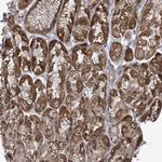 PHLDB2 Antibody in Immunohistochemistry (Paraffin) (IHC (P))