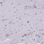 MOBP Antibody in Immunohistochemistry (Paraffin) (IHC (P))