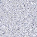 SGOL2 Antibody in Immunohistochemistry (Paraffin) (IHC (P))