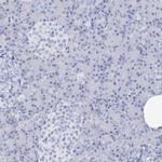 SGOL2 Antibody in Immunohistochemistry (Paraffin) (IHC (P))