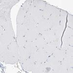 SGOL2 Antibody in Immunohistochemistry (Paraffin) (IHC (P))