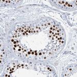 SGOL2 Antibody in Immunohistochemistry (Paraffin) (IHC (P))