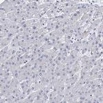 GSTM3 Antibody in Immunohistochemistry (Paraffin) (IHC (P))