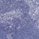 GSTM3 Antibody in Immunohistochemistry (Paraffin) (IHC (P))