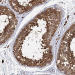 GSTM3 Antibody in Immunohistochemistry (Paraffin) (IHC (P))