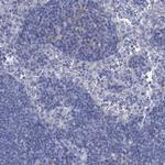 GSTM3 Antibody in Immunohistochemistry (IHC)