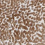 PCYOX1 Antibody in Immunohistochemistry (Paraffin) (IHC (P))