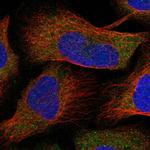 NAGK Antibody in Immunocytochemistry (ICC/IF)