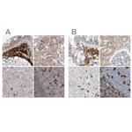 NAGK Antibody in Immunohistochemistry (IHC)