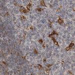 NAGK Antibody in Immunohistochemistry (IHC)