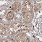 NAGK Antibody in Immunohistochemistry (IHC)