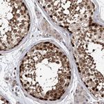 DNAJC9 Antibody in Immunohistochemistry (Paraffin) (IHC (P))