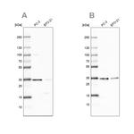 DNAJC9 Antibody in Western Blot (WB)