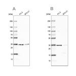 DNAJC9 Antibody in Western Blot (WB)