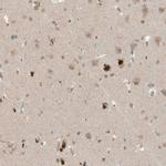 MXI1 Antibody in Immunohistochemistry (IHC)