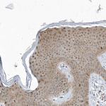 MXI1 Antibody in Immunohistochemistry (IHC)