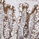 MXI1 Antibody in Immunohistochemistry (IHC)