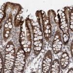 MXI1 Antibody in Immunohistochemistry (IHC)