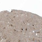 CACNB2 Antibody in Immunohistochemistry (Paraffin) (IHC (P))