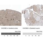 CACNB2 Antibody