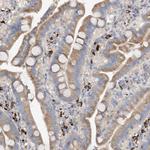 SLC5A11 Antibody in Immunohistochemistry (Paraffin) (IHC (P))