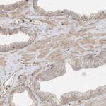 SLC25A12 Antibody in Immunohistochemistry (Paraffin) (IHC (P))