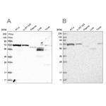 SLC25A12 Antibody in Western Blot (WB)