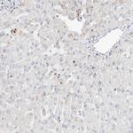 SLC25A12 Antibody in Immunohistochemistry (IHC)