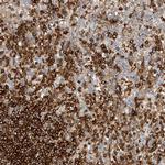 ARHGAP25 Antibody in Immunohistochemistry (IHC)