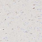 ARHGAP25 Antibody in Immunohistochemistry (IHC)