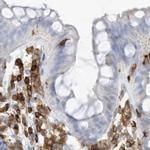 ARHGAP25 Antibody in Immunohistochemistry (IHC)