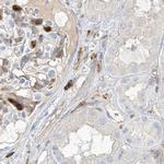 ARHGAP25 Antibody in Immunohistochemistry (IHC)