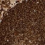 ARHGAP25 Antibody in Immunohistochemistry (IHC)