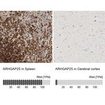 ARHGAP25 Antibody