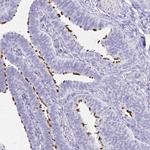 CCDC39 Antibody in Immunohistochemistry (IHC)