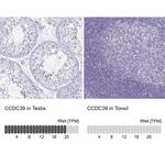 CCDC39 Antibody