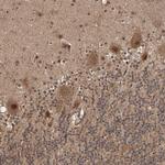 UBR3 Antibody in Immunohistochemistry (Paraffin) (IHC (P))