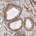 UBR3 Antibody in Immunohistochemistry (Paraffin) (IHC (P))