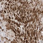 DHX36 Antibody in Immunohistochemistry (Paraffin) (IHC (P))