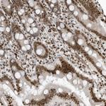 ADI1 Antibody in Immunohistochemistry (Paraffin) (IHC (P))