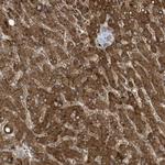 ADI1 Antibody in Immunohistochemistry (Paraffin) (IHC (P))