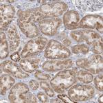 MCAT Antibody in Immunohistochemistry (Paraffin) (IHC (P))