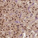 GALM Antibody in Immunohistochemistry (IHC)