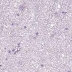 GALM Antibody in Immunohistochemistry (IHC)