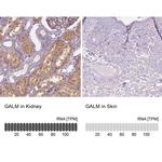 GALM Antibody in Immunohistochemistry (IHC)